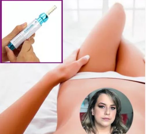 Intradermoterapia pressurizada corporal e capilar: Curso avançado Intradermoterapia pressurizada corporal e capilar